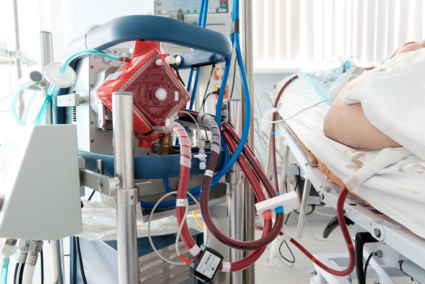 ecmo_GettyImages-998260308官網用.jpg